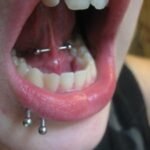 frenulum